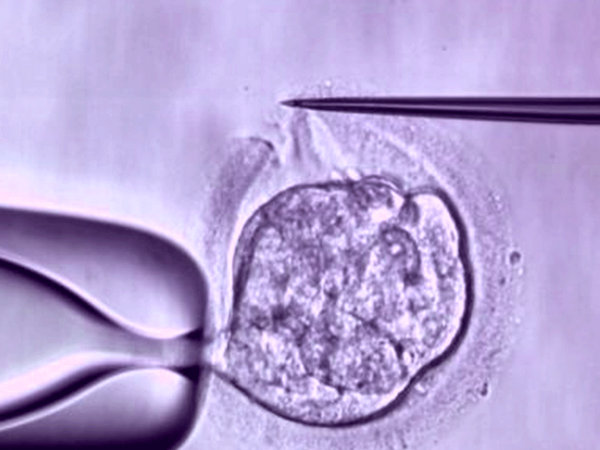 creating an opening in embryo, assisted hatching