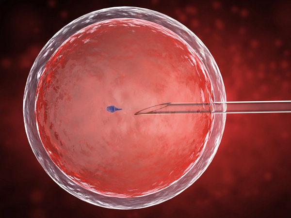 ivf with icsi fertilization