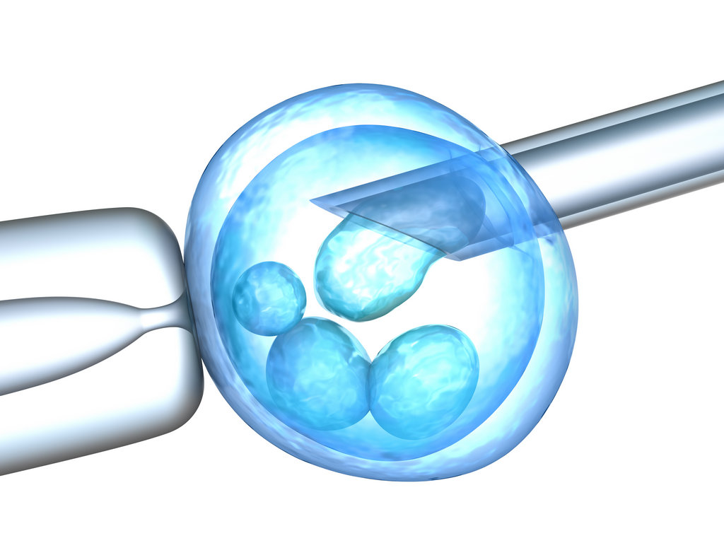 pgd in laboratorio