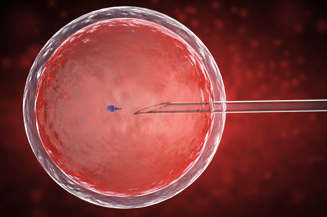 microferilizzazione dell'ovulo