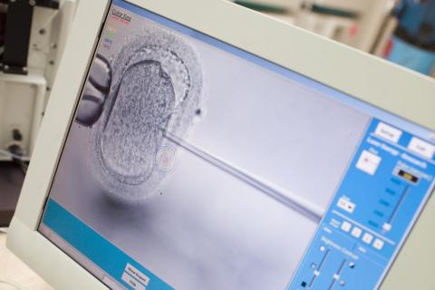 μικρογονιμοποιηση ωαριου στο εμβρυολογικο εργαστηριο