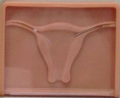 IVF, Fertility Treatment